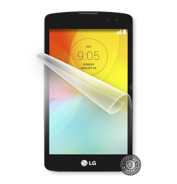 D390N F60 ochrana displeje