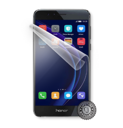 Honor 8 display