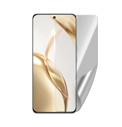 Honor 200 display